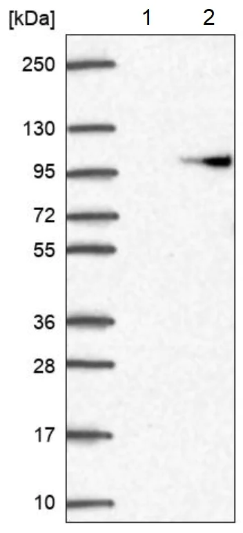 Western blot - Anti-AP2B1 antibody (AB220778)