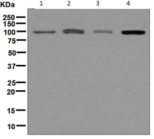 Western blot - Anti-AP2B1 antibody [EPR7567] (AB129168), expandable thumbnail