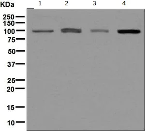 Western blot - Anti-AP2B1 antibody [EPR7567] (AB129168)