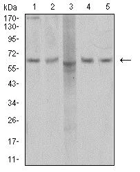 Western blot - Anti-AP2M1 antibody [4F1B2] (AB233712)