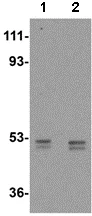 Western blot - Anti-AP2M1 antibody (AB106542)