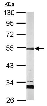 Western blot - Anti-AP2M1 antibody (AB137727)