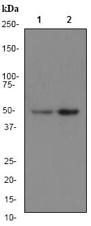 Western blot - Anti-AP2M1 antibody [EP2695Y] (AB75995)