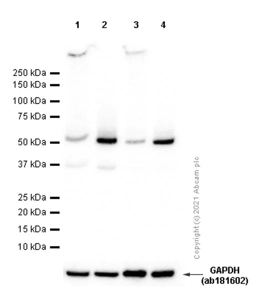 Western blot - Anti-AP2M1 antibody [EP2695Y] (AB75995)