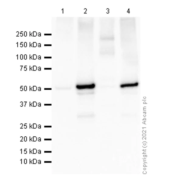 Western blot - Anti-AP2M1 (phospho T156) antibody [EPR4700] - BSA and Azide free (AB247848)