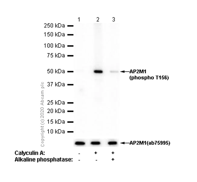 Western blot - Anti-AP2M1 (phospho T156) antibody [EPR4700] - BSA and Azide free (AB247848)