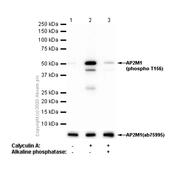 Western blot - Anti-AP2M1 (phospho T156) antibody [EPR4700] - BSA and Azide free (AB247848)