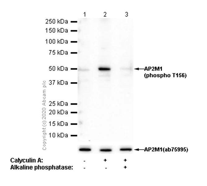 Western blot - Anti-AP2M1 (phospho T156) antibody [EPR4700] - BSA and Azide free (AB247848)