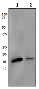 Western blot - Anti-AP2S1 antibody [EPR2696] (AB92380)