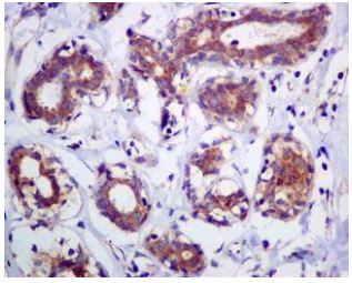 Immunohistochemistry (Formalin/PFA-fixed paraffin-embedded sections) - Anti-AP2S1 antibody [EPR2697(2)] (ab128950), expandable thumbnail