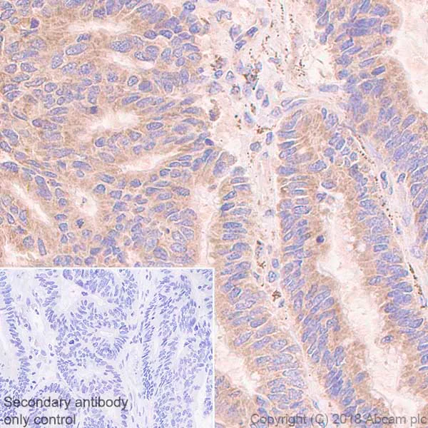 Immunohistochemistry (Formalin/PFA-fixed paraffin-embedded sections) - Anti-AP2S1 antibody [EPR2697(2)] (AB128950)