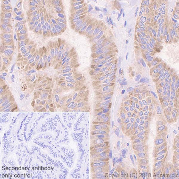 Immunohistochemistry (Formalin/PFA-fixed paraffin-embedded sections) - Anti-AP2S1 antibody [EPR2697(2)] (AB128950), expandable thumbnail