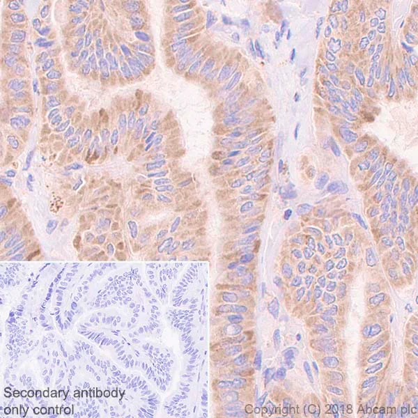 Immunohistochemistry (Formalin/PFA-fixed paraffin-embedded sections) - Anti-AP2S1 antibody [EPR2697(2)] (AB128950)