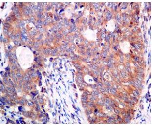 Immunohistochemistry (Formalin/PFA-fixed paraffin-embedded sections) - Anti-AP2S1 antibody [EPR2697(2)] (ab128950), expandable thumbnail