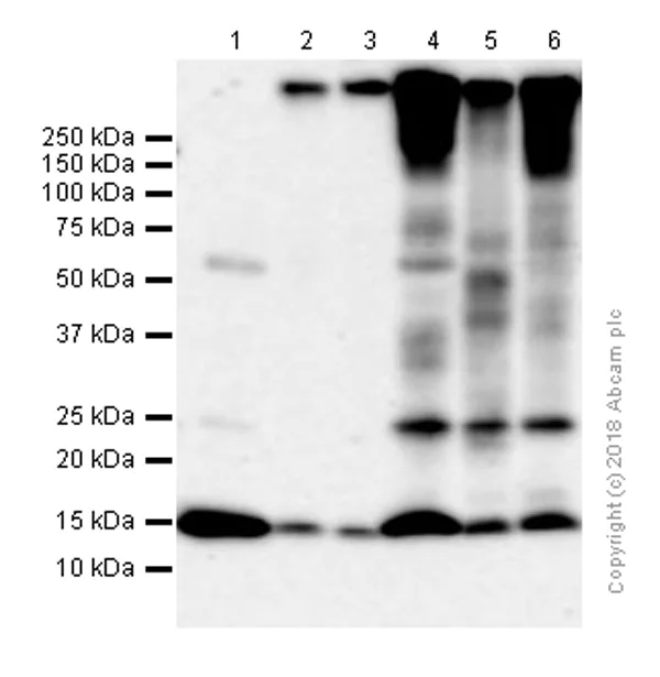 Western blot - Anti-AP2S1 antibody [EPR2697(2)] (AB128950)