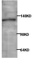 Western blot - Anti-AP3 antibody (AB85075)