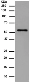 Western blot - Anti-AP3M2 antibody [EPR12965] - BSA and Azide free (AB250149)
