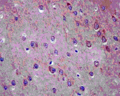 Immunohistochemistry (Formalin/PFA-fixed paraffin-embedded sections) - Anti-AP3M2 antibody [EPR12966] (AB182000), expandable thumbnail