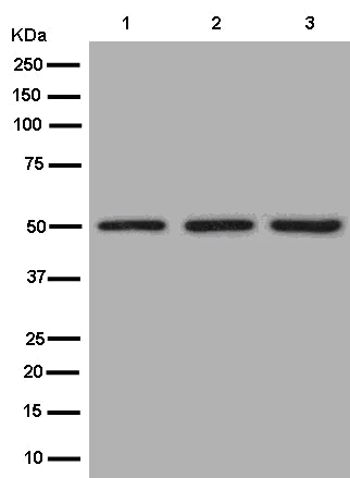 Western blot - Anti-AP3M2 antibody [EPR12966] (AB182000)