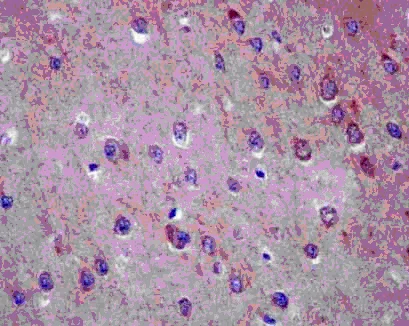 Immunohistochemistry (Formalin/PFA-fixed paraffin-embedded sections) - Anti-AP3M2 antibody [EPR12966] - BSA and Azide free (AB250565)