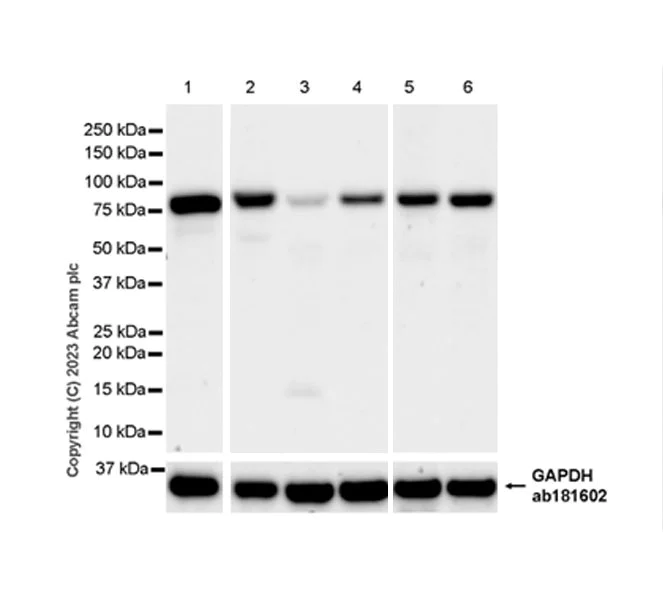 Western blot - Anti-AP4B1 antibody [EPR28048-85] (AB316002)