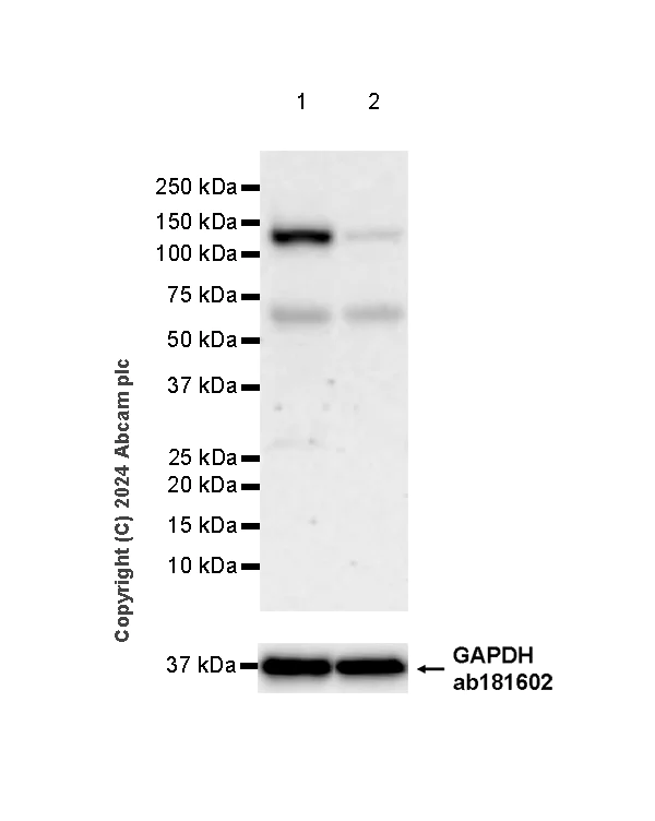 Western blot - Anti-AP4E1 antibody [EPR28049-87] (AB318189)