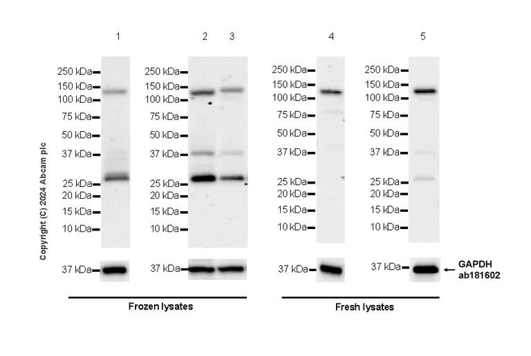 Western blot - Anti-AP4E1 antibody [EPR28049-87] - BSA and Azide free (AB318190)