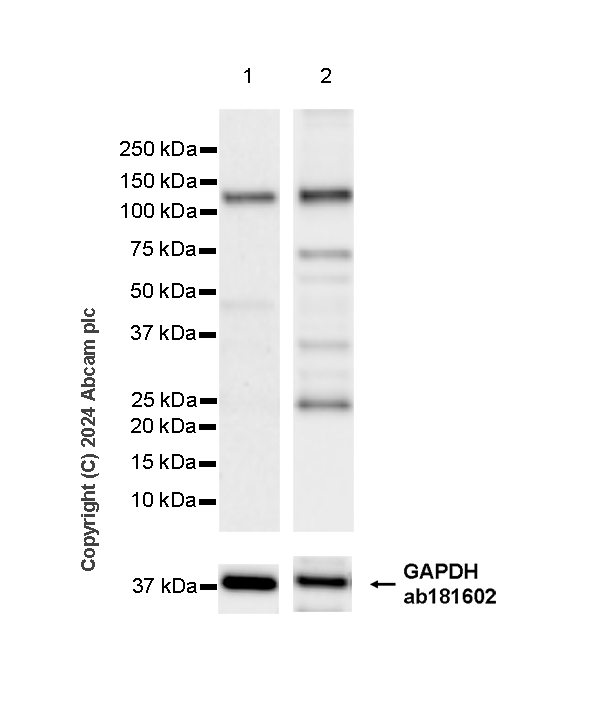 Western blot - Anti-AP4E1 antibody [EPR28049-87] - BSA and Azide free (AB318190)