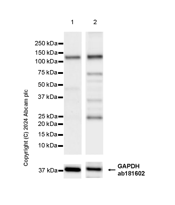 Western blot - Anti-AP4E1 antibody [EPR28049-87] - BSA and Azide free (AB318190)