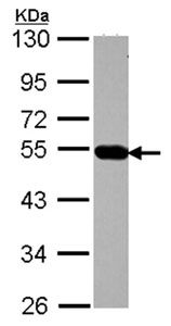 Western blot - Anti-AP4M1 antibody (AB96306), expandable thumbnail