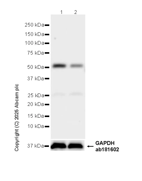 Western blot - Anti-AP4M1 antibody [EPR28050-10] (AB323641)