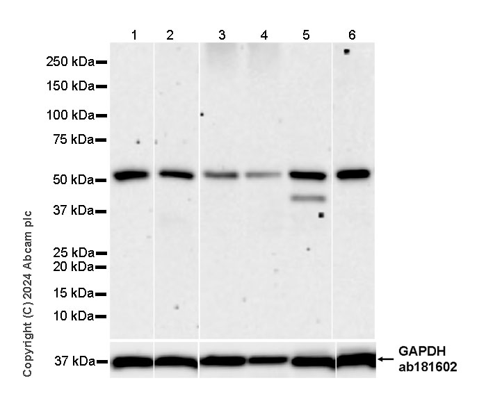 Western blot - Anti-AP4M1 antibody [EPR28050-10] (AB323641), expandable thumbnail
