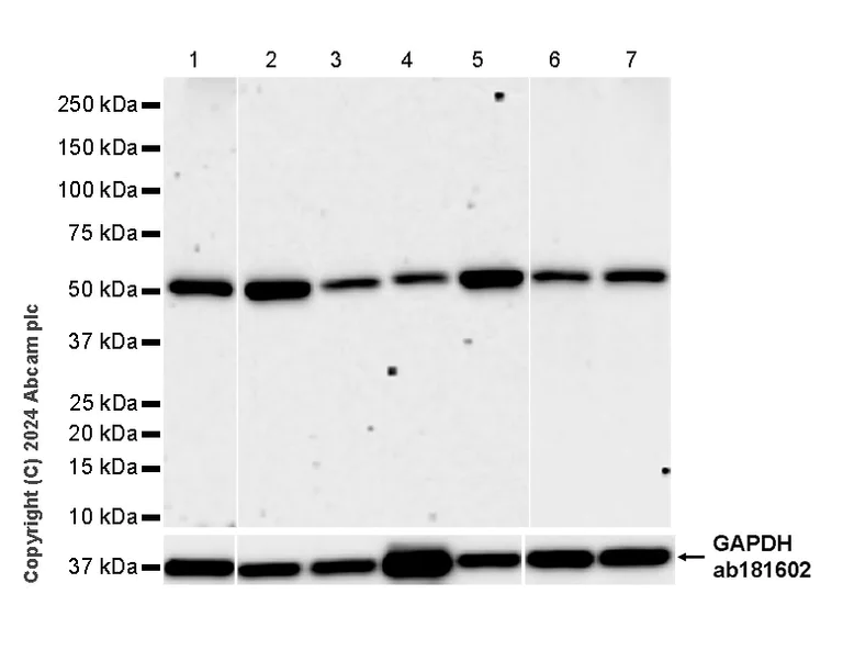 Western blot - Anti-AP4M1 antibody [EPR28050-10] (AB323641)