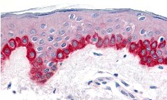 Immunohistochemistry (Formalin/PFA-fixed paraffin-embedded sections) - Anti-APAF1 antibody (AB2000)