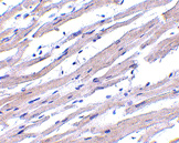 Immunohistochemistry (Formalin/PFA-fixed paraffin-embedded sections) - Anti-APAF1 antibody (AB2001)