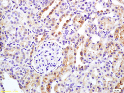 Immunohistochemistry (Formalin/PFA-fixed paraffin-embedded sections) - Anti-APAF1 antibody (AB216410)