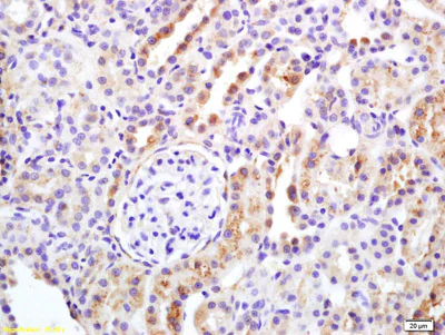Immunohistochemistry (Formalin/PFA-fixed paraffin-embedded sections) - Anti-APAF1 antibody (AB216410)