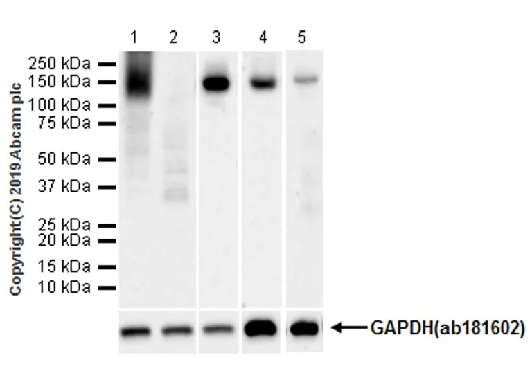 Western blot - Anti-APAF1 antibody [EPR21112-102] (AB234436)