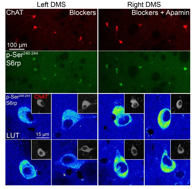 Immunohistochemistry - Apamin, blocker of small conductance Ca2+-activated K+ channels (AB120268)