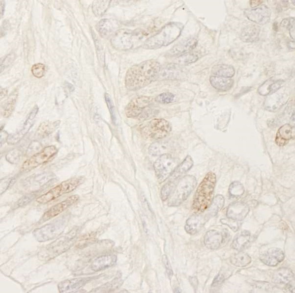 Immunohistochemistry (Formalin/PFA-fixed paraffin-embedded sections) - Anti-APC antibody (AB245442)