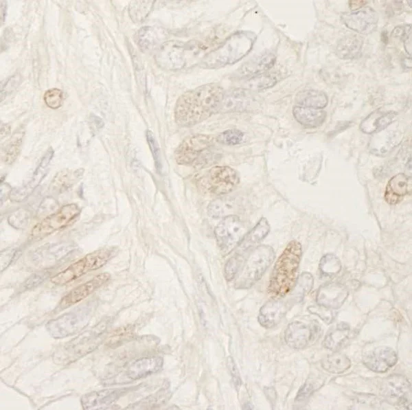 Immunohistochemistry (Formalin/PFA-fixed paraffin-embedded sections) - Anti-APC antibody (AB245442)