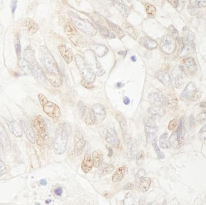 Immunohistochemistry (Formalin/PFA-fixed paraffin-embedded sections) - Anti-APC antibody (AB265597)
