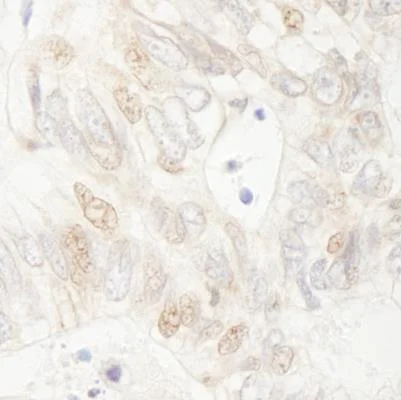 Immunohistochemistry (Formalin/PFA-fixed paraffin-embedded sections) - Anti-APC antibody (AB265597)