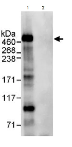 Immunoprecipitation - Anti-APC antibody (AB265597)