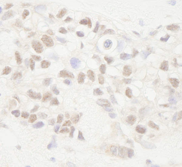 Immunohistochemistry (Formalin/PFA-fixed paraffin-embedded sections) - Anti-APC antibody (AB72040), expandable thumbnail