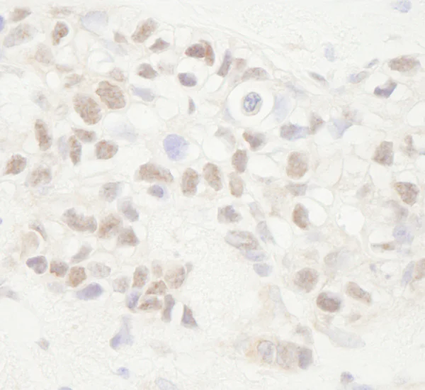 Immunohistochemistry (Formalin/PFA-fixed paraffin-embedded sections) - Anti-APC antibody (AB72040)