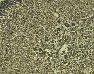 Anti-APC antibody [CC-1] - mouse monoclonal (ab16794) | Abcam