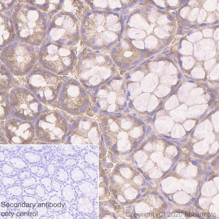 Immunohistochemistry (Formalin/PFA-fixed paraffin-embedded sections) - Anti-APC antibody [EP701Y] (AB40778)