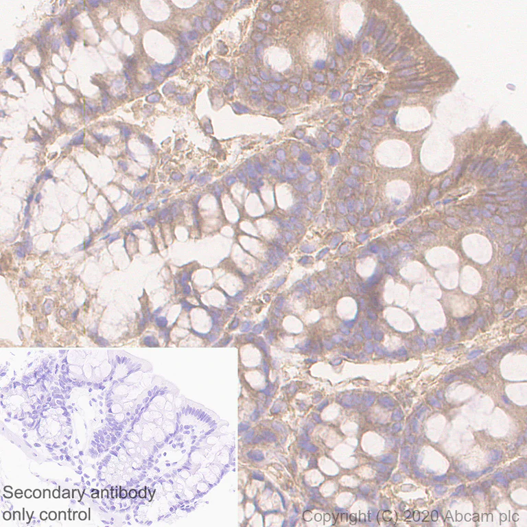 Immunohistochemistry (Formalin/PFA-fixed paraffin-embedded sections) - Anti-APC antibody [EP701Y] (AB40778)