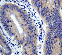 Immunohistochemistry (Formalin/PFA-fixed paraffin-embedded sections) - Anti-APC antibody [EP701Y] - BSA and Azide free (AB239828)